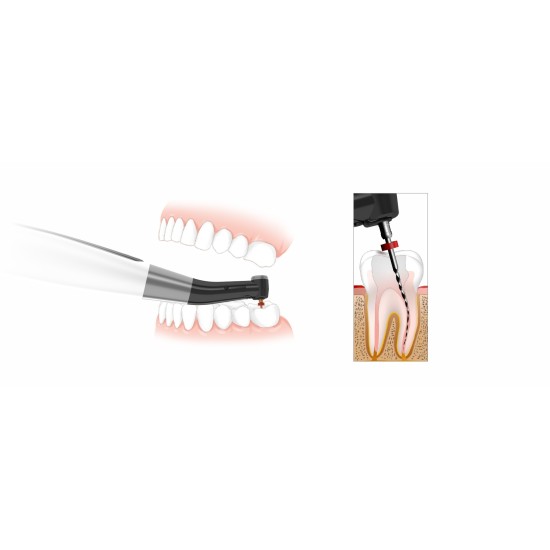 Woodpecker EndoMatic® Cordless Endo Motor with builtin Apex Locator