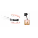 Woodpecker EndoMatic® Cordless Endo Motor with builtin Apex Locator