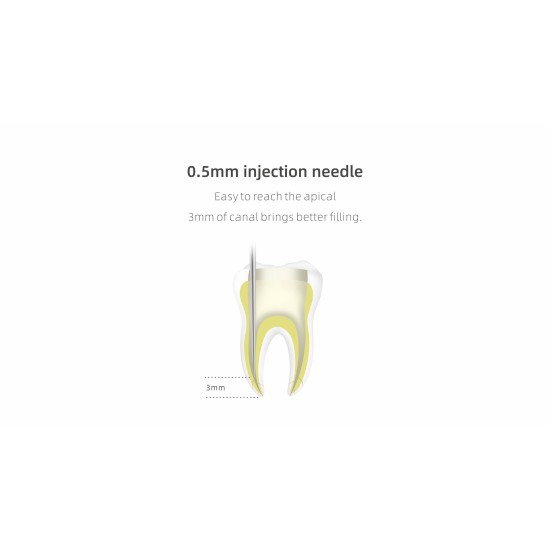 Woodpecker® Endo Cordless Gutta-Percha Obturation System
